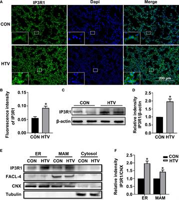 Inhibition of IP3R/Ca2+ Dysregulation Protects Mice From Ventilator-Induced Lung Injury via Endoplasmic Reticulum and Mitochondrial Pathways